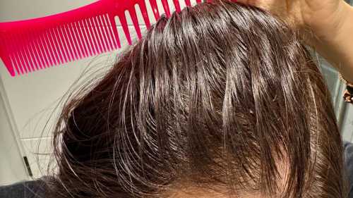 TikTok-манія викликає випадіння волосся: тривожні заяви фахівців