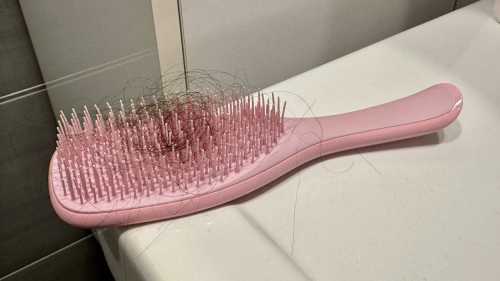 “Дрімаючі” волосяні фолікули: правда чи вигадка? Справжні причини втрати волосся