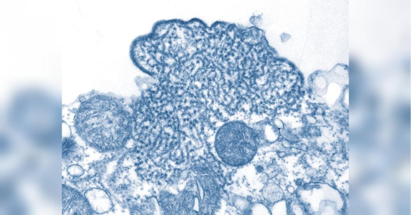 Смертельний вірус шириться світом: що треба знати про загрозливу недугу