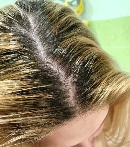 Головна 188 Два шкідливих та три дієвих лайфхаки для власниць жирного волосся