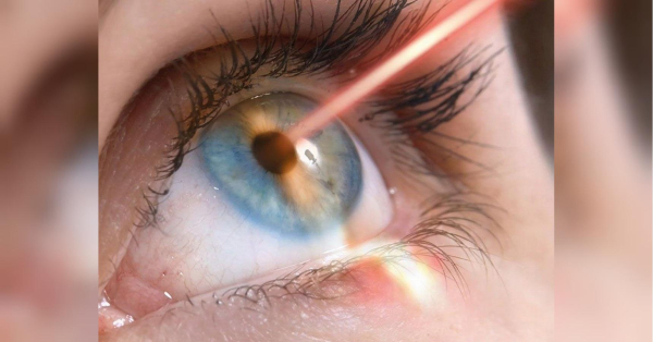 Лазерна корекція зору: вичерпна інструкція для позбавлення від окулярів