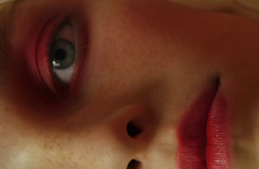 Головна 164 Обличчя без почервоніння: дієвий метод від судинних зірочок