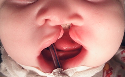 Щелепно-лицева хірургія в Києві: професорський підхід до складних операцій 2