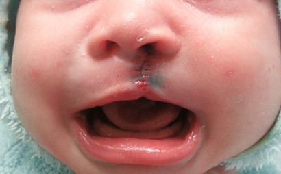 Щелепно-лицева хірургія в Києві: професорський підхід до складних операцій 3