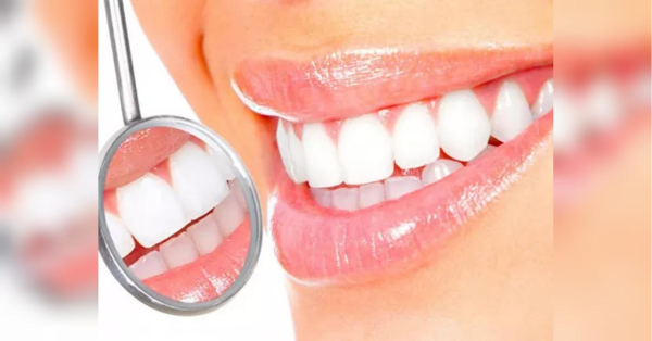 Не тільки солодощі: щоденні руйнівники зубів