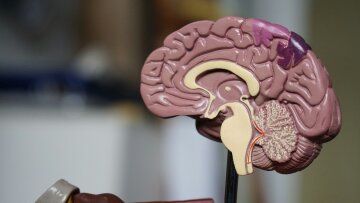 ШІ вперше допоміг видалити пухлину мозку: британські хірурги врятували зір пацієнта2